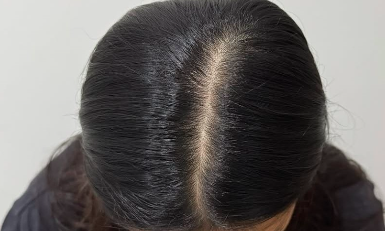 Après — Densification capillaire femme chez Pigment Hair Paris
