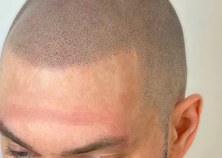 Avant — Ligne