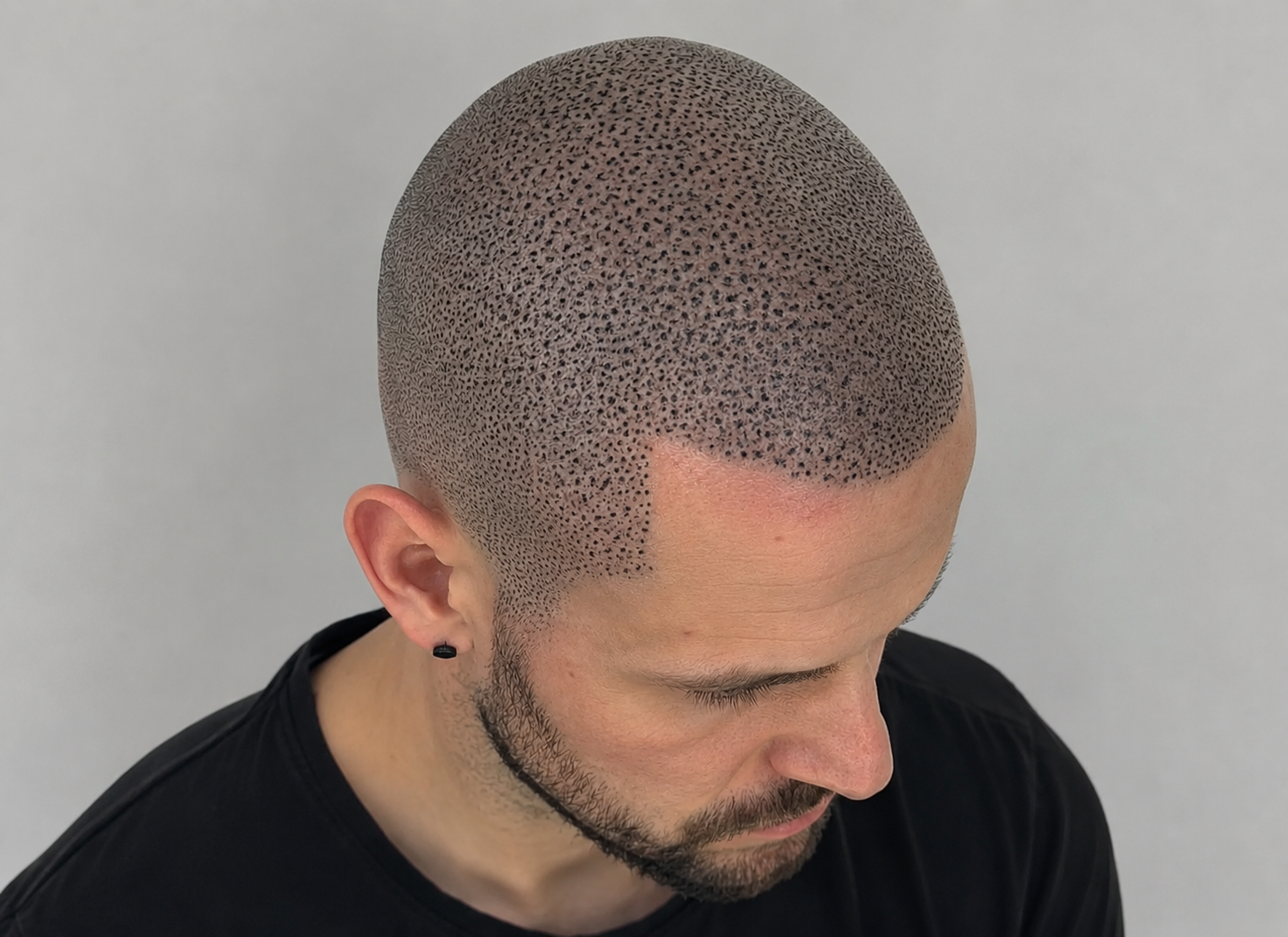 2. L'effet "casque" : le manque de précision du geste