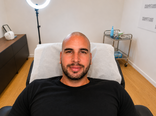 Témoignage client : David partage son expérience après sa tricopigmentation