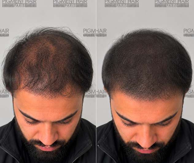 Découvrez Hakim